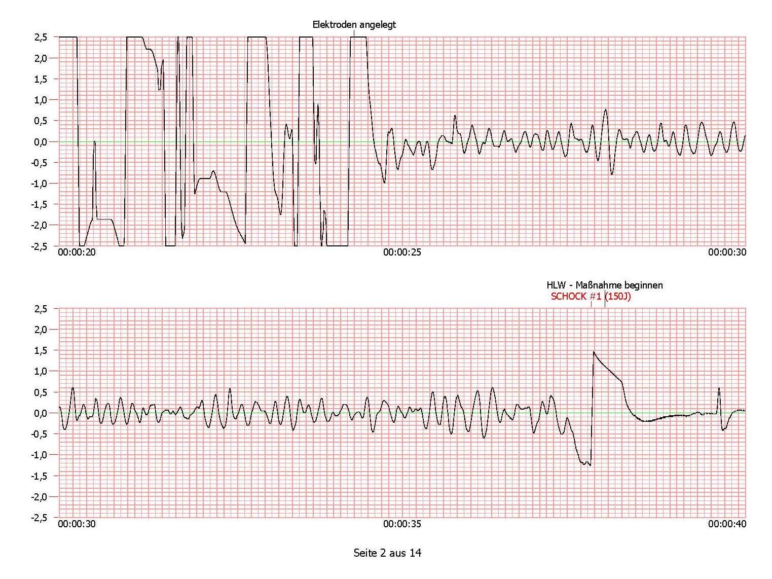 HeartSine Defibrillator Wiederaufbereitung, inkl. Leihgerät, Forward Hearts Programm